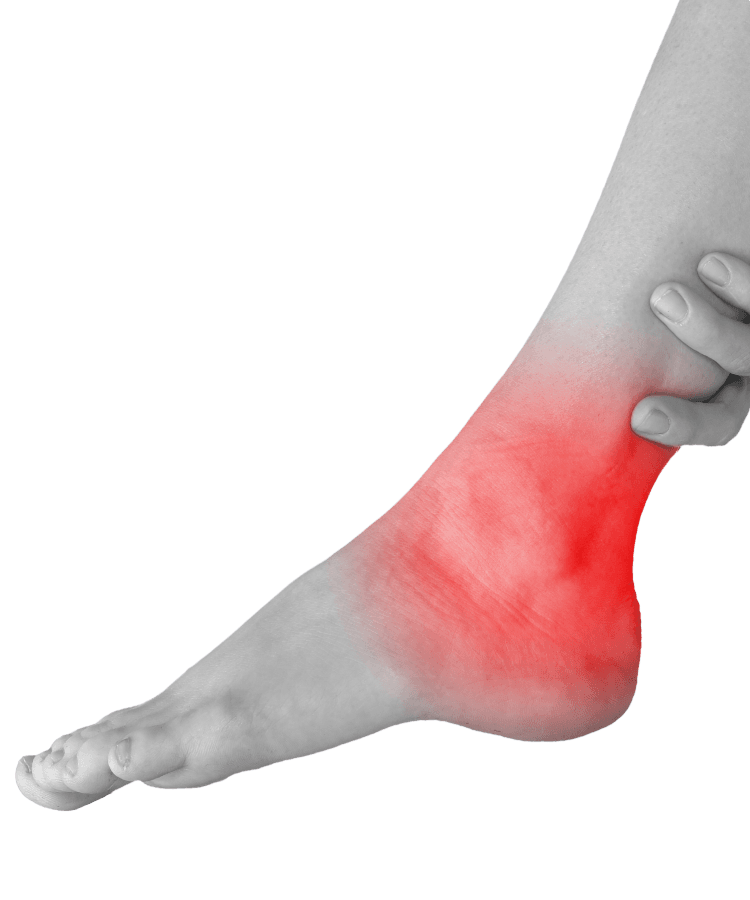 Heel or ankle pain